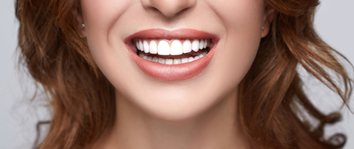 Teeth Whitening in Bristol