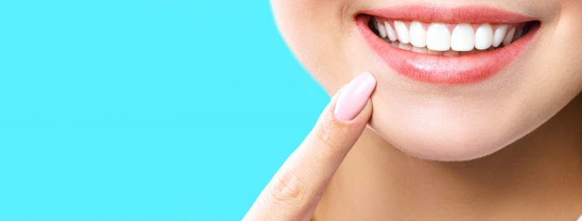 professional teeth whitening safe