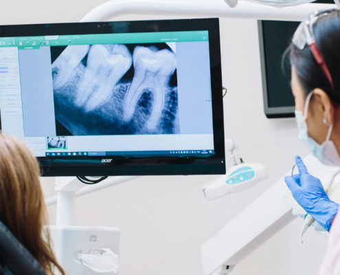 Root Canal Treatment