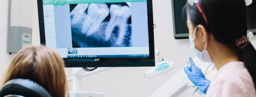 Root Canal Treatment